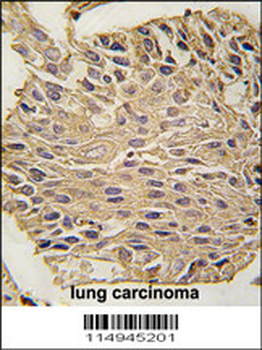 ALDOA Antibody (C-term)