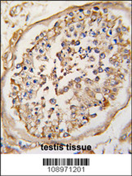 NPTX2 Antibody (Center)