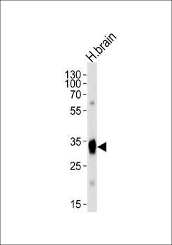 SULT4A1a/b Antibody (N-term)