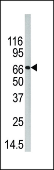 PAD4 Antibody (C-term)