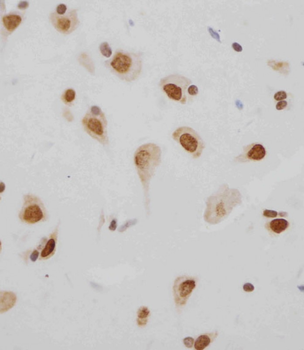 MeCP2 Antibody