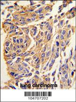 PPT1 Antibody (C-term)