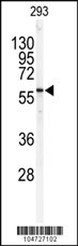 SPTLC1 Antibody (C-term)