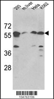 SPTLC1 Antibody (N-term)