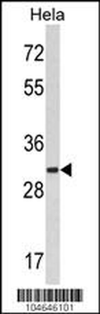 MARCKS Antibody (C-term)