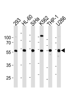 YY1 Antibody (N-term)