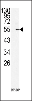 BMI1 Antibody (C-term)