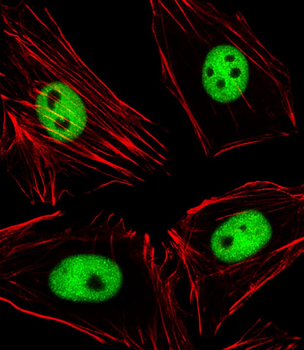 EZH2 Antibody