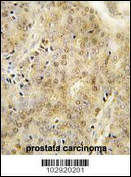 EZH1 Antibody (Center)