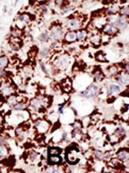 GPI8 Antibody (C-term)