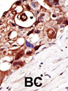 GPI8 Antibody (N-term)