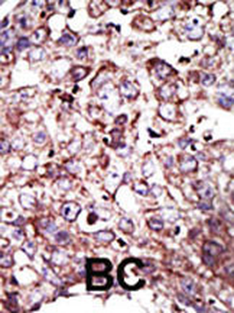 FNTA Antibody (C-term)