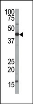 FNTA Antibody (Center)