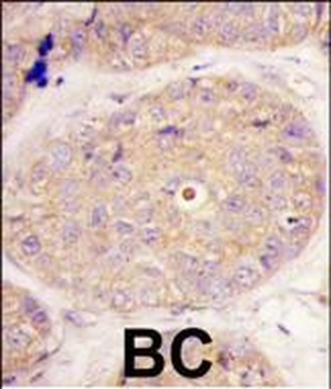 GGPS1 Antibody (C-term)
