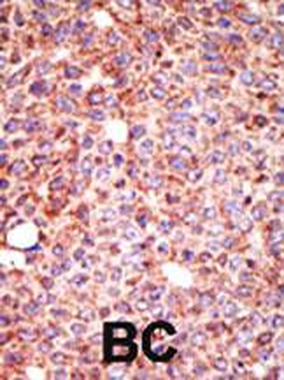 MGAT3 Antibody (N-term)