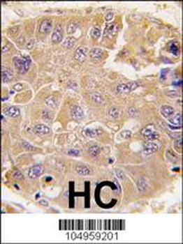 Methionine Aminopeptidase 2 (METAP2) Antibody (C-term)