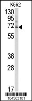 Ubiquilin3 Antibody (N-term)