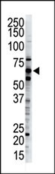 Dsk2 Antibody (C-term)