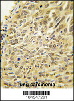 Dsk2 Antibody (N-term)