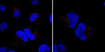 Mib1/Mindbomb Antibody (N-term)