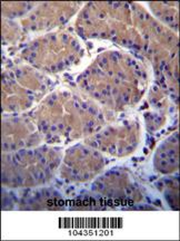 USP20 Antibody (C-term)
