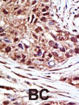 USP14 Antibody (N-term)