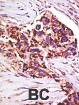 USP13 Antibody (Center)