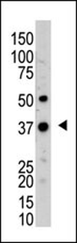 UCH37 (UCHL5) Antibody (N-term)