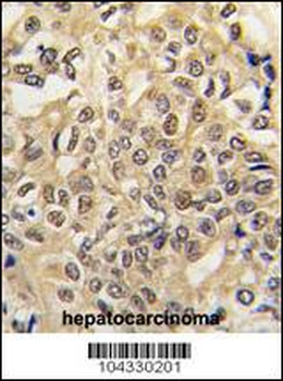 E1 Ubiquitin (UBE1) Antibody (C-term)