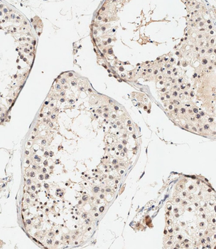 UBE4B Antibody (N-term)