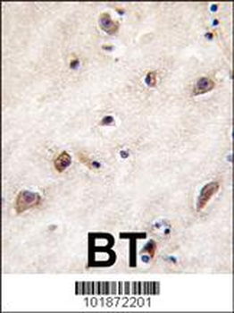 GDF1 Antibody (N-term)