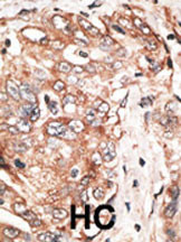 P100 Antibody