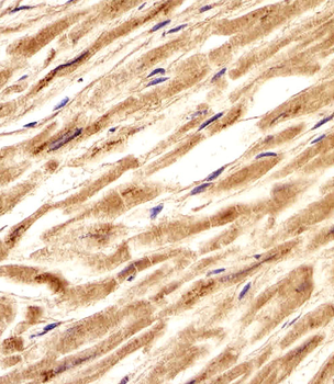 CNBP Antibody (Center)