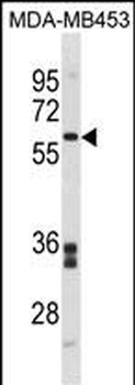 FMO5 Antibody (C-term)