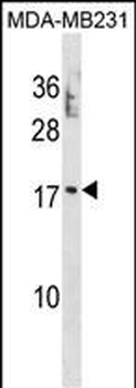 PTRH2 Antibody (N-term)