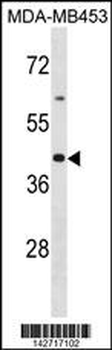 OR2B6 Antibody (C-term)
