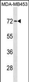 MEX3C Antibody (C-term)