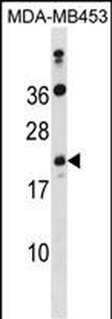 ATP5S Antibody (N-term)