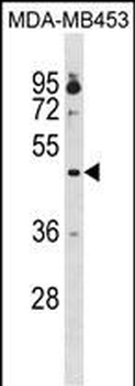 OPRK1 Antibody (Center)