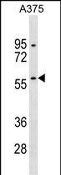 RBCK1 Antibody (N-term)