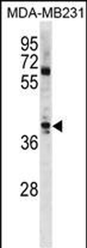 ATOH1 Antibody (C-term)
