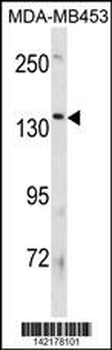 ATP8B3 Antibody (N-term)