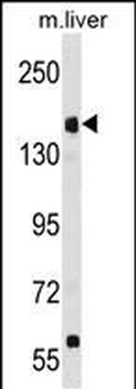 UBR1 Antibody (N-term)