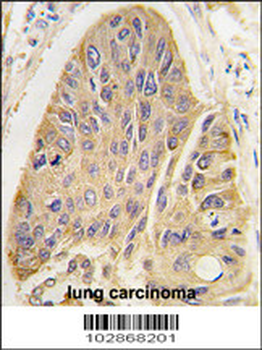 MAP2 Antibody (C-term)