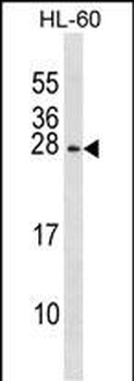 RGS2 Antibody (N-term)