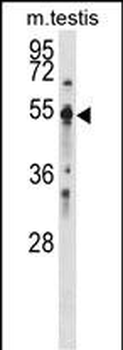 PTPN1 Antibody (Center)