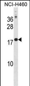 CSH1 Antibody (N-term)