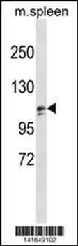 ZNF516 Antibody (Center)