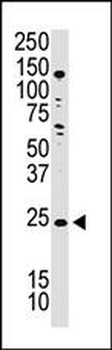 Podoplanin / GP36 / T1A-2 Antibody (N-term)