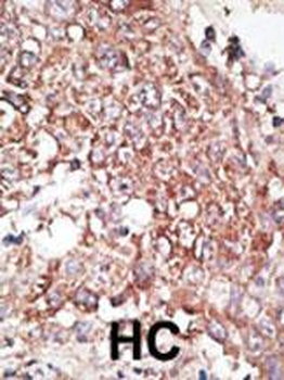 LYVE1 (XLKD1) Antibody (C-term)